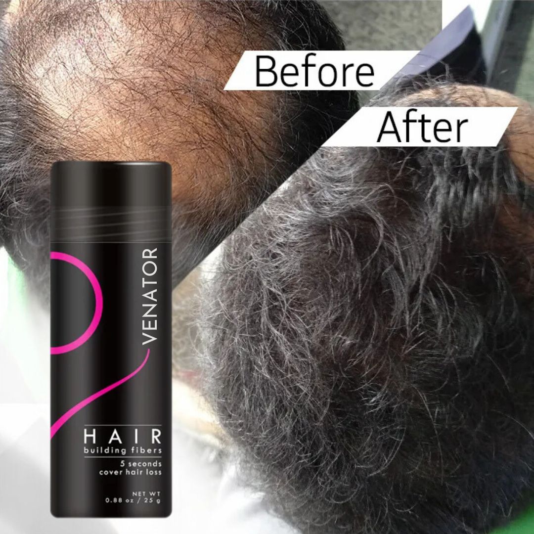 Ventra™ Instant Hair Filler