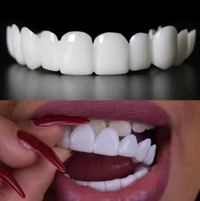 Ventra™ Temporary Veneers
