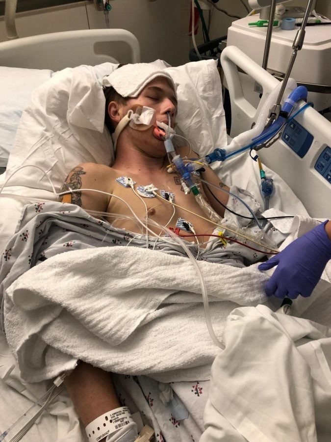 My brother in an ICU bed after his lung collapsed
