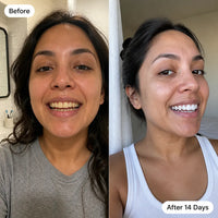 Premium Coconut Oil Whitening Strips