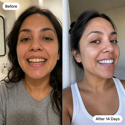 Premium Coconut Oil Whitening Strips