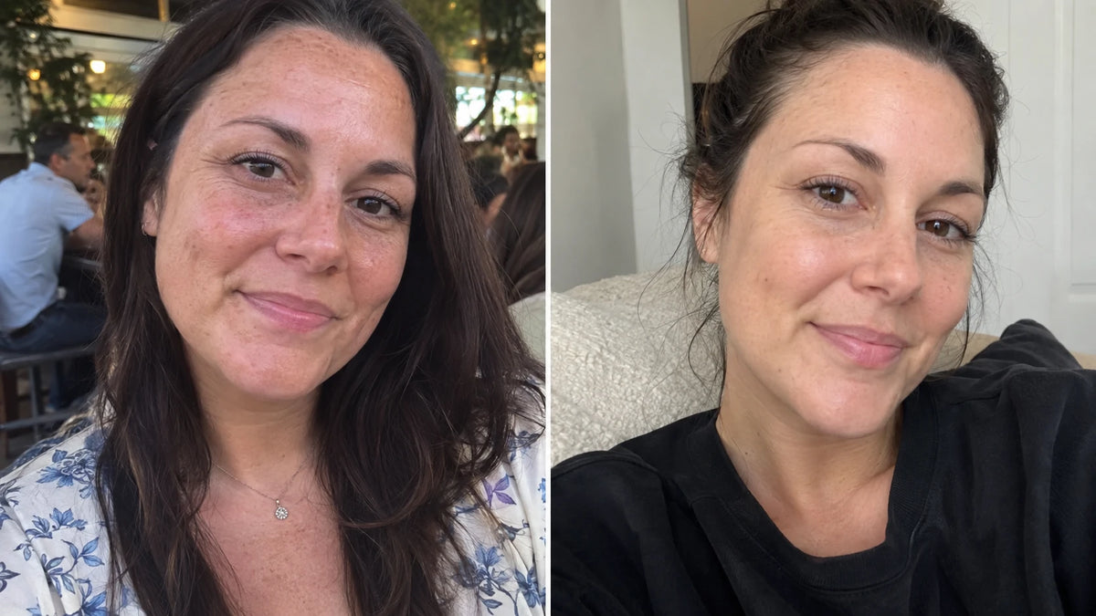 AI-generated comparison of the same adult woman, with smoother-looking facial skin and a more even-looking tone on the right.